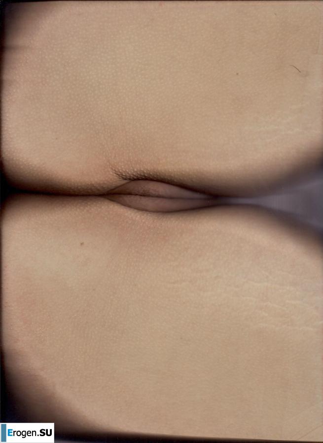 nitsche so. Slide 29