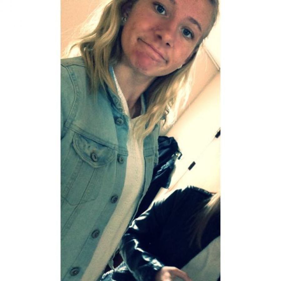 Acne selfie. Slide 31
