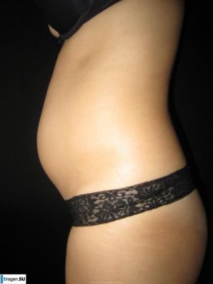 naked pregnant girl. Thumb 24